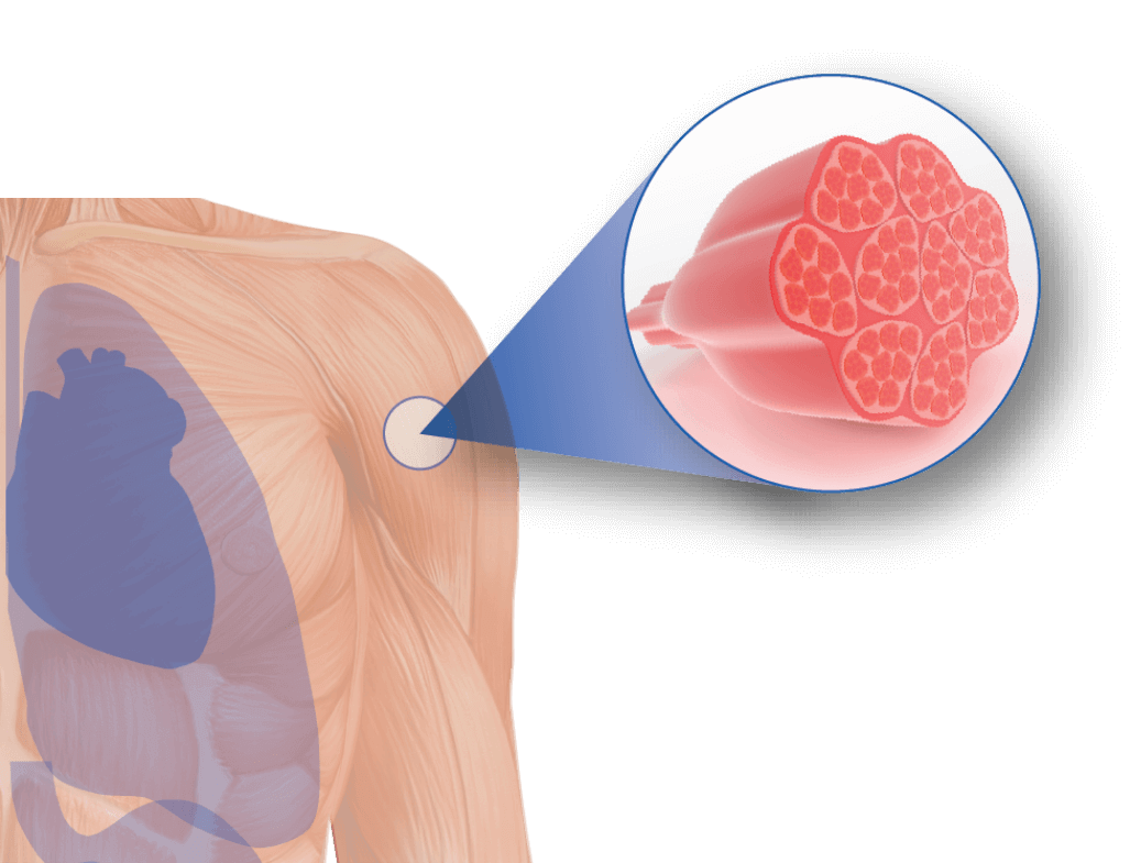 targeted muscle therapies